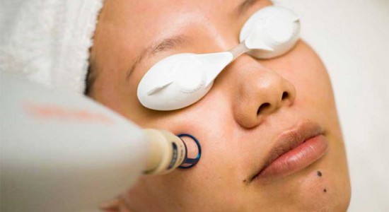 MANHATTAN LASER SPA - MANHATTAN