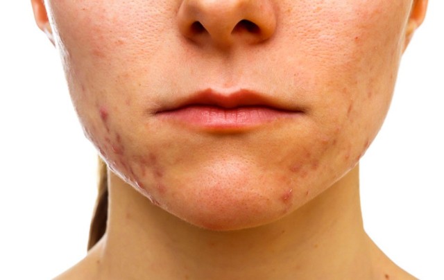 KLING DERMATOLOGY - BROOKLYN